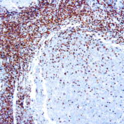 Formalin fixed paraffin embedded human tonsil stained with CD45/LCA antibody.