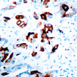Formalin fixed paraffin embedded human breast stained with Mammaglobin-A