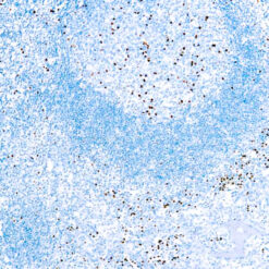 Formalin fixed paraffin embedded human tonsil stained with MUM1 protein antibody.