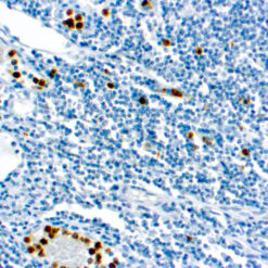 Formalin fixed paraffin embedded human tonsil stained with Myeloperoxidase antibody
