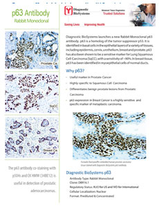 p63Flyer Sep2020 New