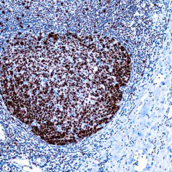 Formalin fixed paraffin embedded human tonsil stained with PCNA antibody.