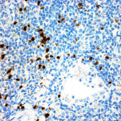 Formalin fixed paraffin embedded human tonsil stained with Tdt antibody