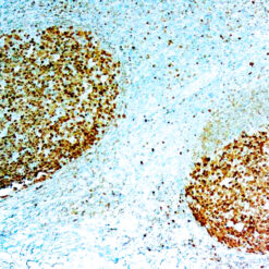 Formalin fixed paraffin embedded human Tonsil stained with BOB.1