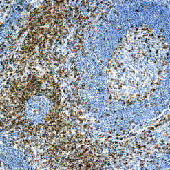 Formalin fixed paraffin embedded human tonsil stained with CD5