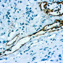 Formalin fixed paraffin embedded human Tonsil stained with Podoplanin/D2-40