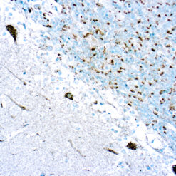 Formalin fixed paraffin embedded huma Cerebellum stained with Pan-TRK.