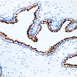 Formalin fixed paraffin embedded human prostate stained with NKX3.1.