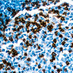 Formalin fixed paraffin embedded human tonsil stained with PD-1.