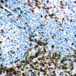Formalin fixed paraffin embedded human Tonsil stained with CD3.