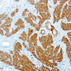 Formalin fixed paraffin embedded human uterus stained with Calponin
