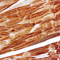 Formalin fixed paraffin embedded human skeletal muscle stained with Actin, Sarcomeric