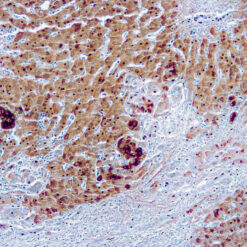 Formalin fixed paraffin embedded human Fetal liver stained with α-Fetoprotein (AFP)