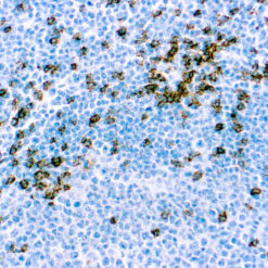 Formalin fixed paraffin embedded human tonsil stained with CD8