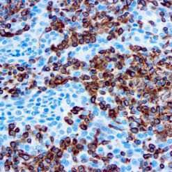 Formalin fixed paraffin embedded human tonsil stained with Vimentin antibody