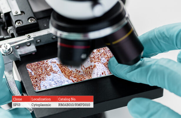 DBS Calretinin Antibody