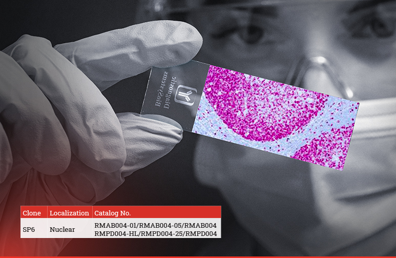 Ki 67 Diagnostic BioSystems blog