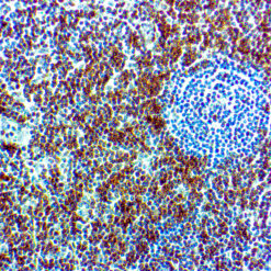 Formalin fixed paraffin embedded human tonsil tissue stained with CD7