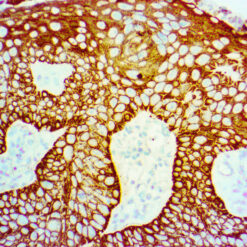 Formalin fixed paraffin embedded human tonsil tissue stained with CKAE1/AE3/8+18 cocktail