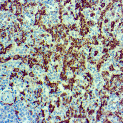 Formalin fixed paraffin embedded human spleen tissue stained with Iba1