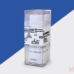 Formalin fixed paraffin embedded human Bladder Carcinoma stained with Uroplakin II & III Cocktail