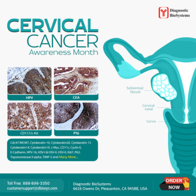 Cervical Cancer