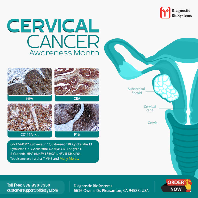 Cervical Cancer