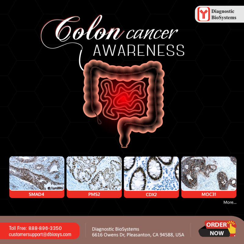 Colorectal Cancer Awareness Month