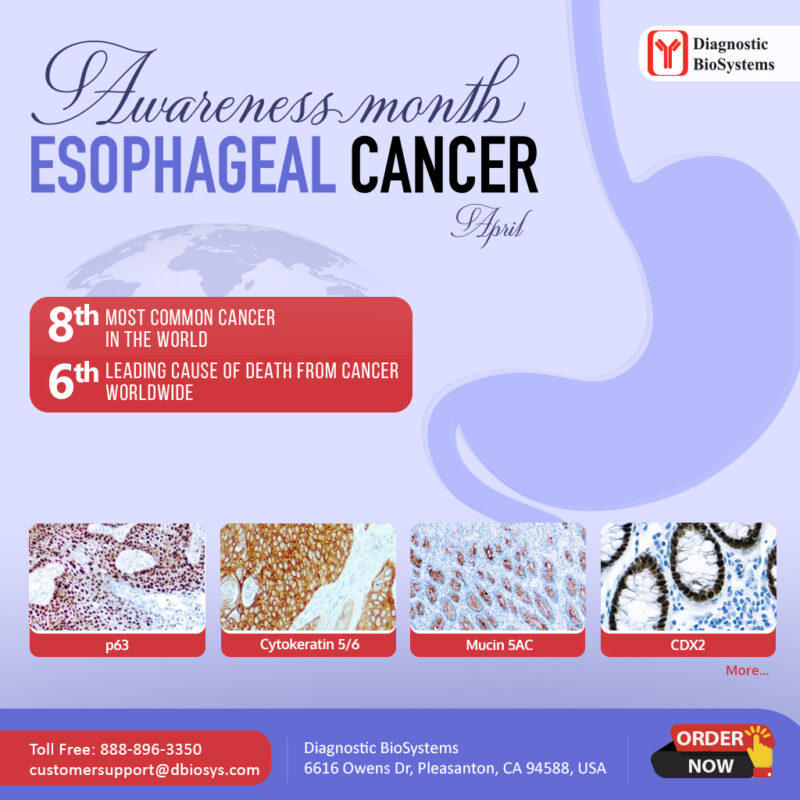 Esophageal Cancer Awareness Social DBS