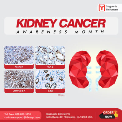 Kidney Cancer