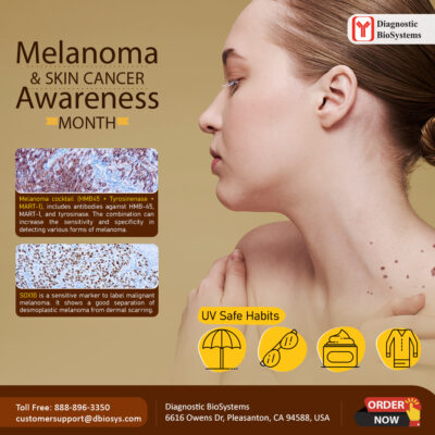 Melanoma Skin Cancer Awareness Diagnostic BioSystems