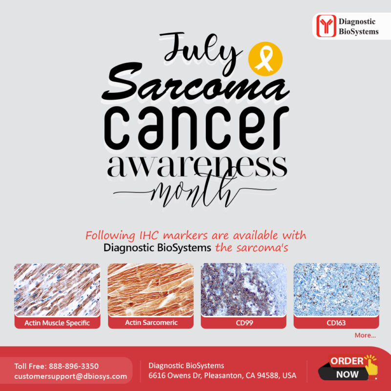 Sarcoma 2022