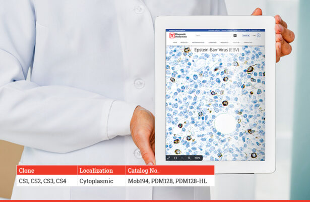 Epstein Barr virus EBV