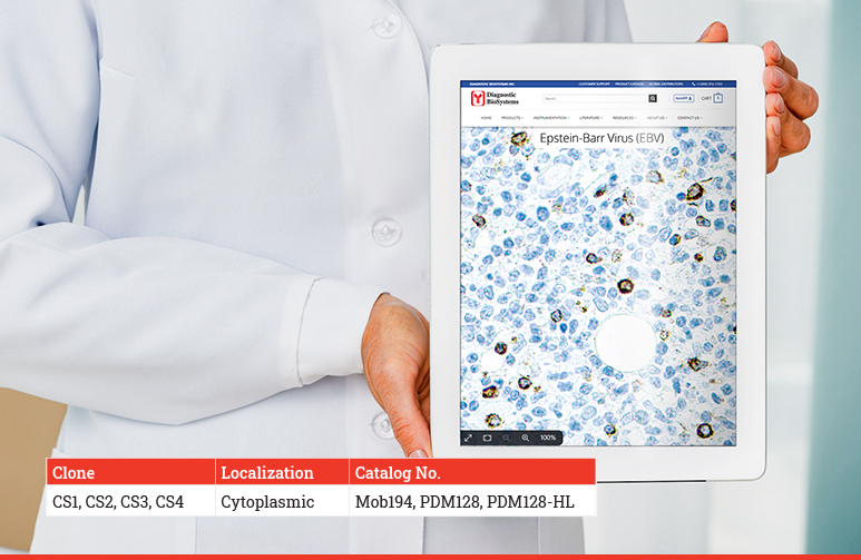 Epstein Barr virus EBV