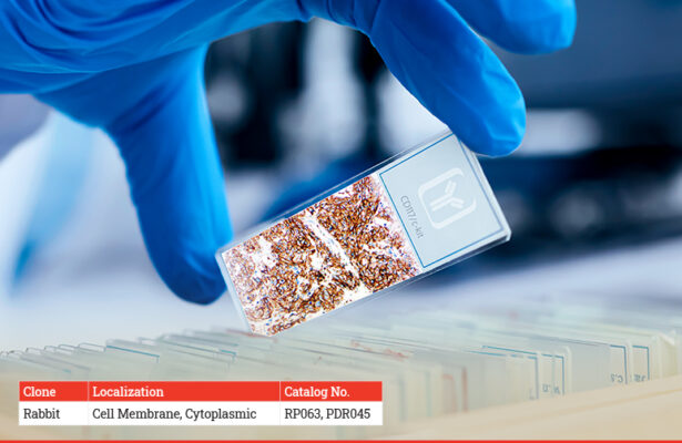 Diagnostic BioSystems CD 117