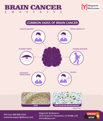 brain cancer awareness