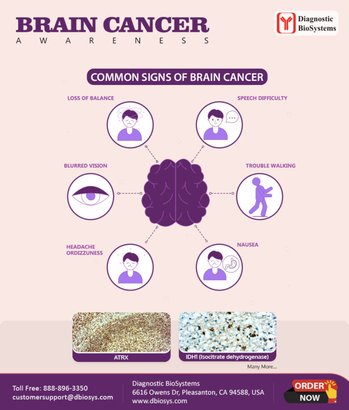 brain cancer awareness