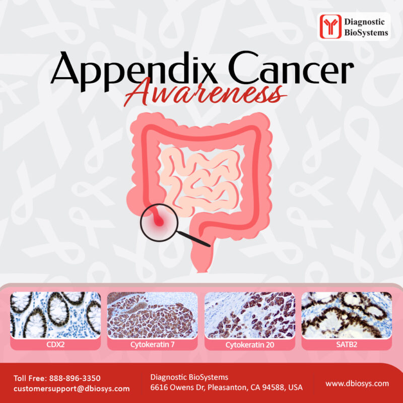 Appendix Cancer Awareness