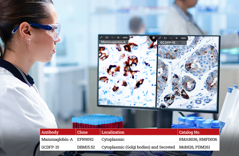 GCDFP 15 and Mammaglobin A