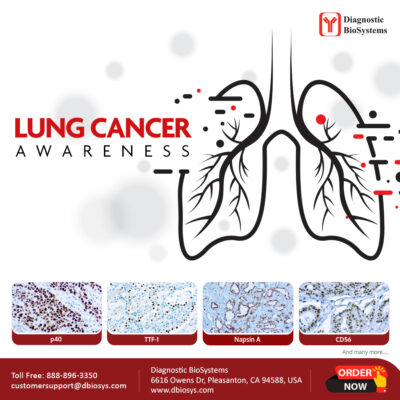 Lung Cancer Awareness 2023
