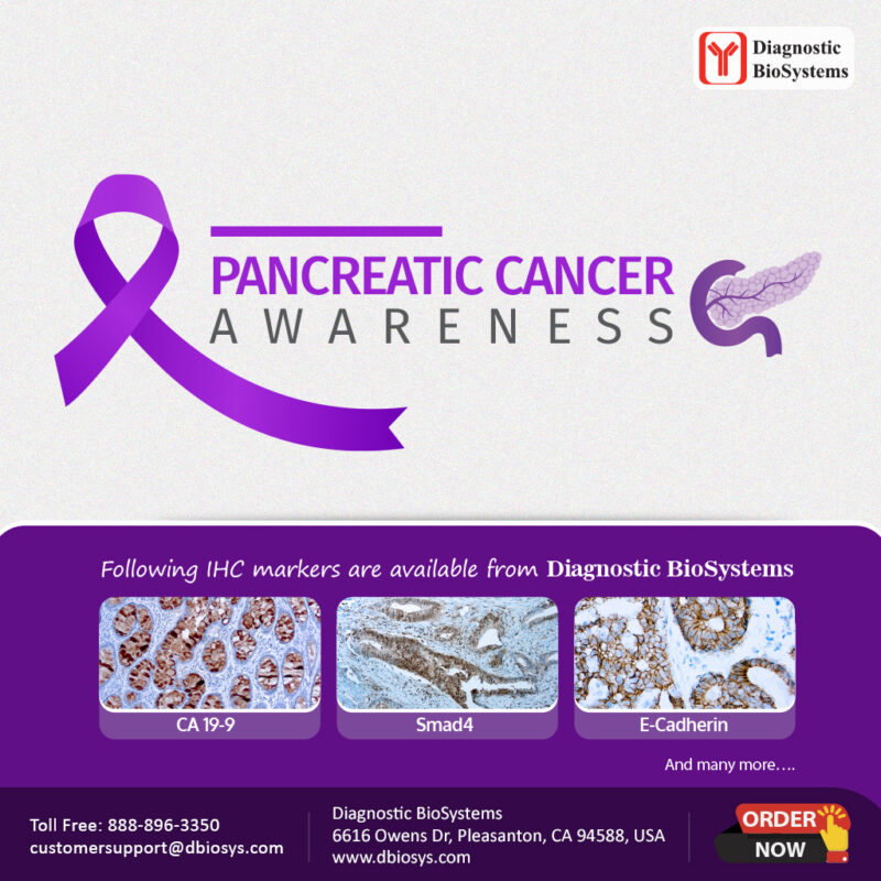 Pancreatic-Cancer