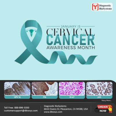 Cervical Cancer