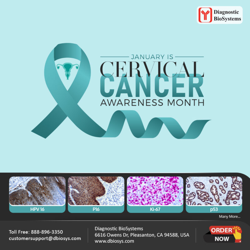 Cervical Cancer