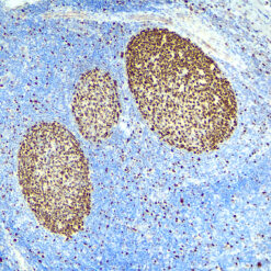 Formalin fixed paraffin embedded human Tonsil stained with MCM7.