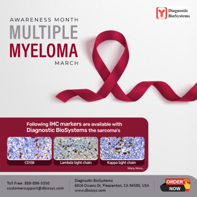 Multiple Myeloma 2024