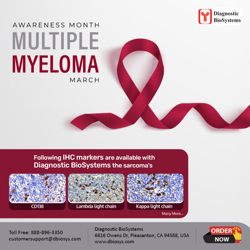 Multiple Myeloma 2024